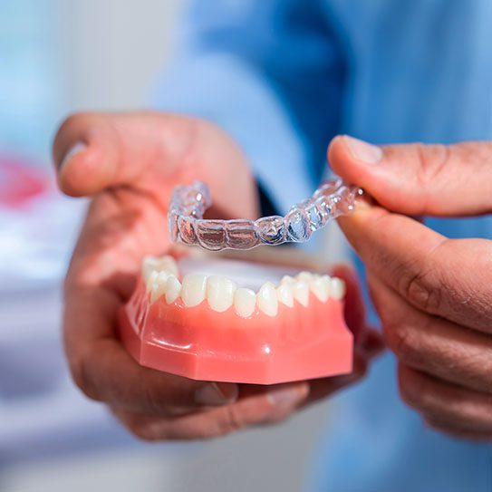 clear aligners